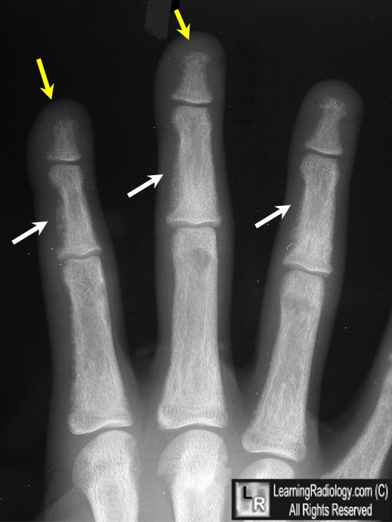 LearningRadiology