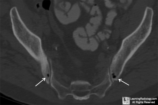 LearningRadiology