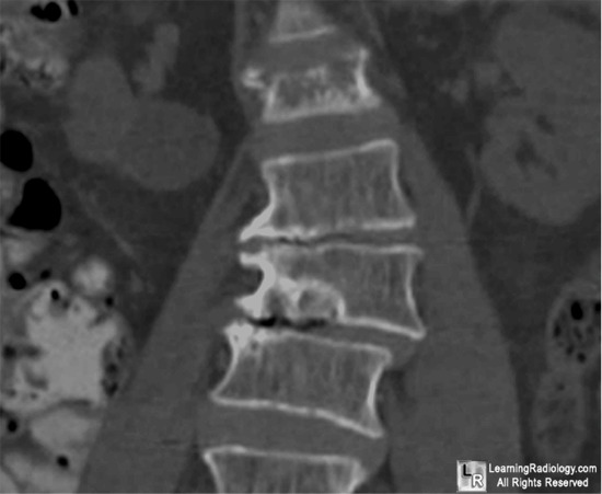 Welcome to LearningRadiology