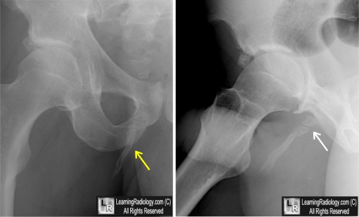 LearningRadiology