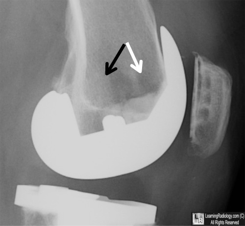 LearningRadiology