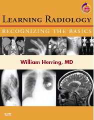 Learning Radiology: Recognizing the Basics