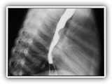 Pulmonary sling-042