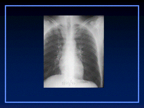 Natural History Of A Lesion Days Natural History Of A Lesion Days