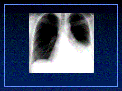 Natural History Of A Lesion Days Natural History Of A Lesion Days