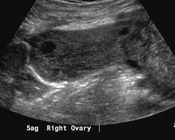 sag ROV