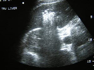P1010014