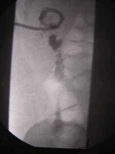 P1010016