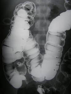P1010015