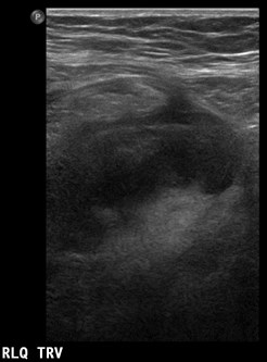 area of pain, lat to ROV 2.jpg
