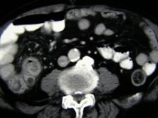 P7210036