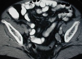 On, H-5 8-03 nl appendix