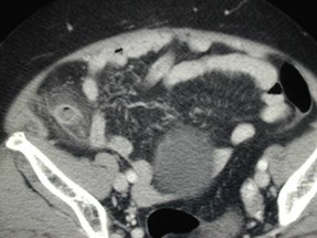 Photos 11-9-03 045