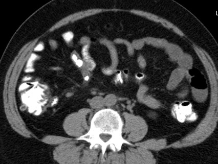 3 previous study, liths missed.jpg