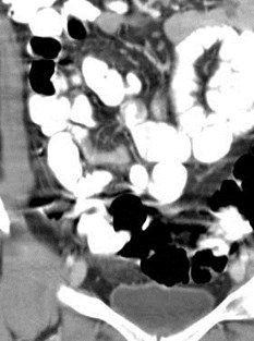 Initial CT 1-6-08 cor