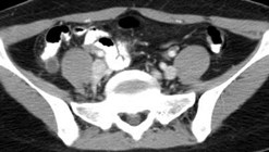 Follow up, rec pain 3-30-08 2