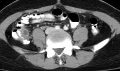 Follow up, rec pain 3-30-08 1