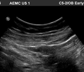 TA 5-2 transducer in tube.jpg