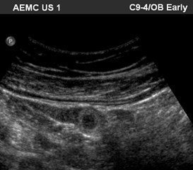 TA 9-4 transducer in tube.jpg