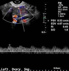 color, Doppler Corpus l.jpg