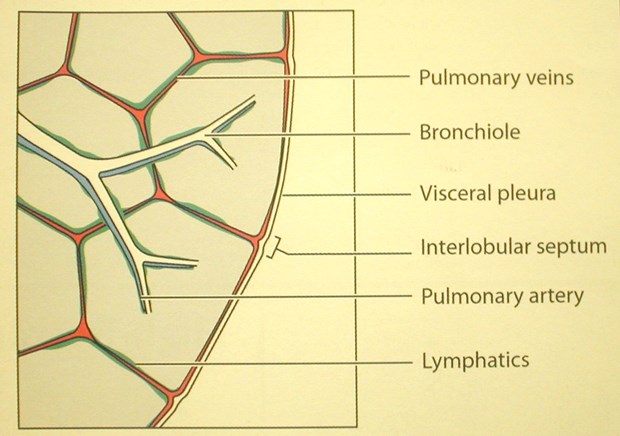 X:\New Folder\HRCT diagram 001.jpg