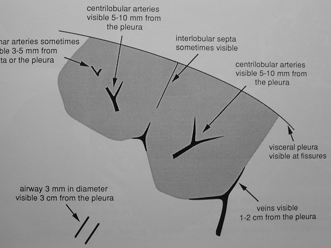 lobule diagram 2                                               0000F615Macintosh HD                   ABA78158: