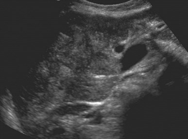 US R lobe masses