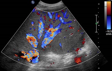 color hep veins