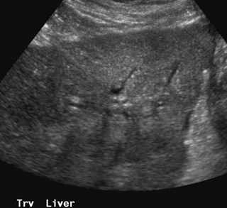 nodular contour