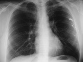 PA2.JPG                                                        0003150EMacintosh HD                   BA578DA3: