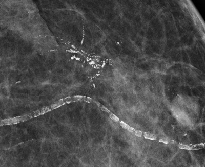34N0Q8DO_1101181213_0001.JPG