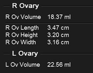 US 2012 ovarian volumes.jpg