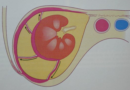 Color Diagram of Perinephric Spread