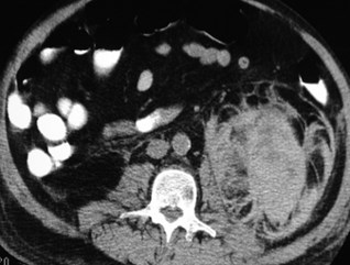 Perry-RCC with subcap bleed-CT2