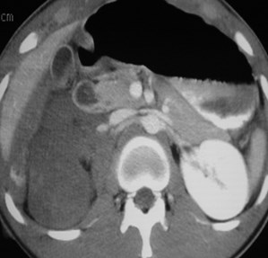Trauma- Renal A