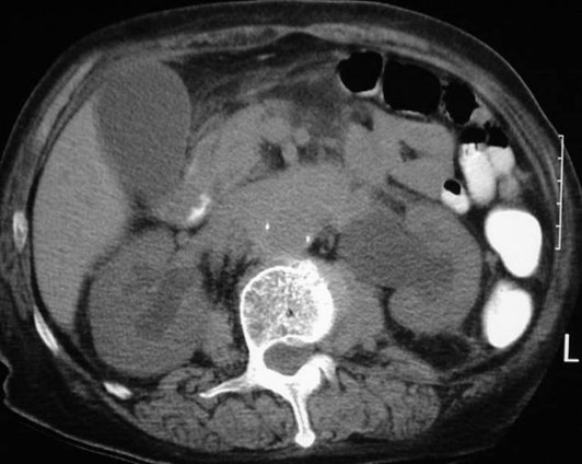 Henderson-RPF-CT