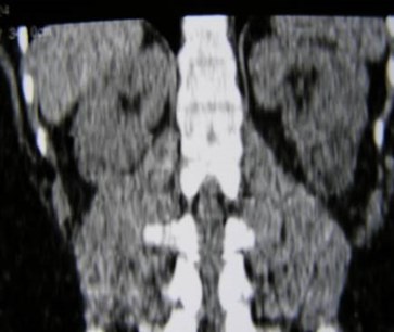 PA040027