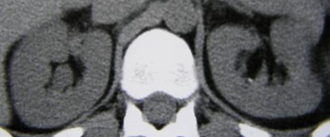 PA050026