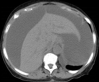 CT 2