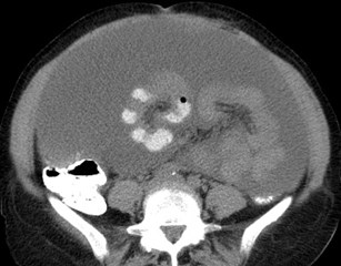 CT 1
