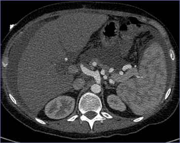 1- CT.jpg