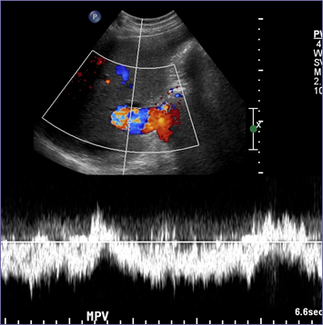 Pulsed Doppler.jpg