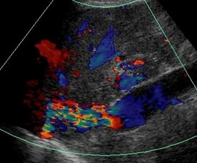 sag IVC color.jpg