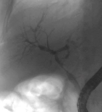 ERCP.jpg