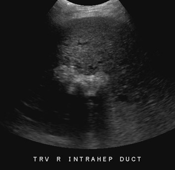 trv central ducts with stones-sludge.jpg