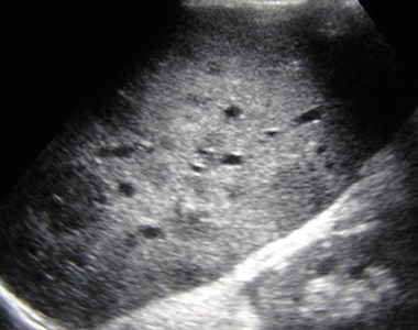 P3100018