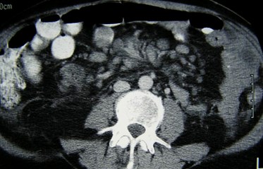 P3100022