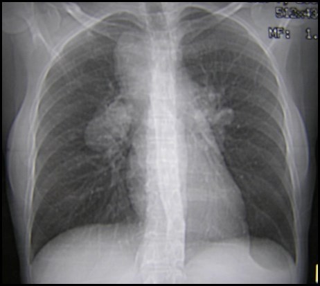 P3100028