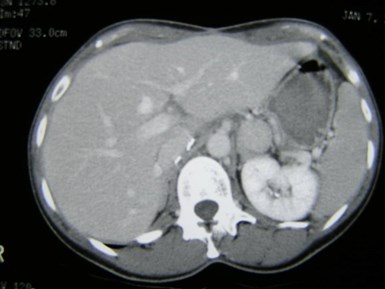 P3100030