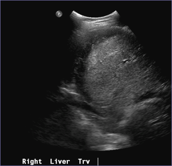 r lobe trv.jpg